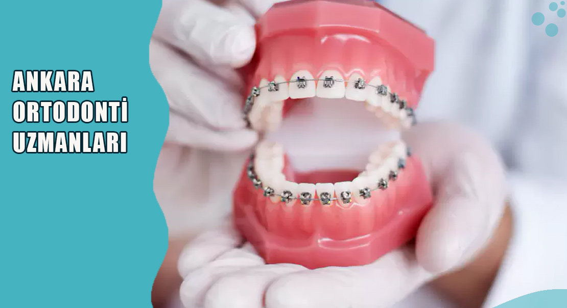 Ankara Ortodonti Uzmanları Tavsiye